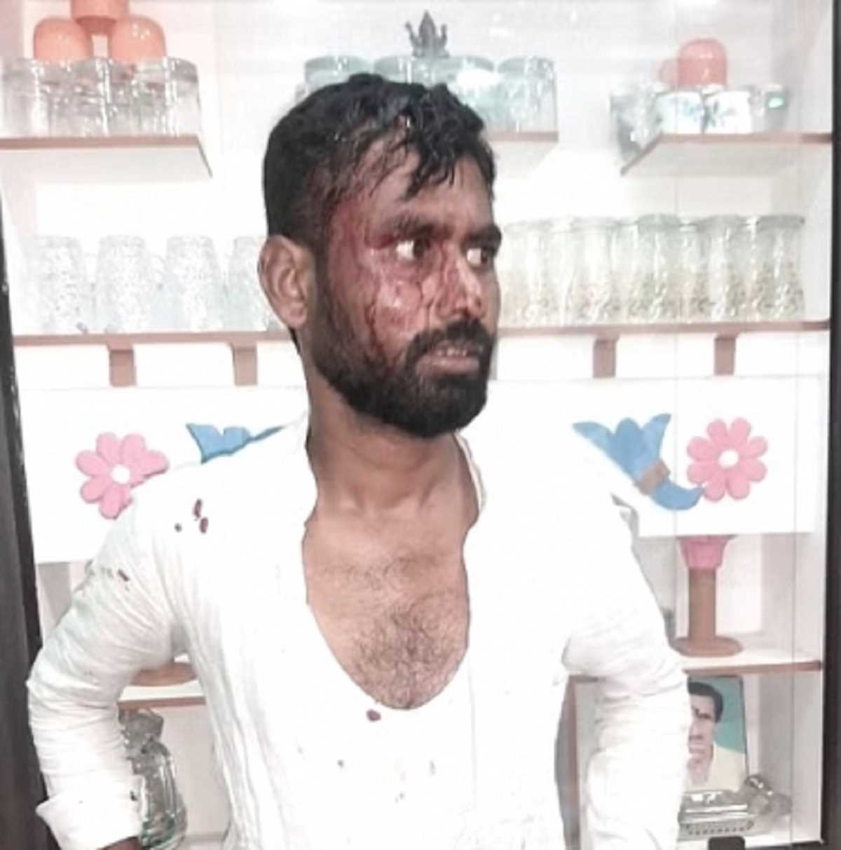 बेल्लारी ग्रामीण में वोटिंग के दौरान हुई झड़प में कांग्रेस नेता घायल